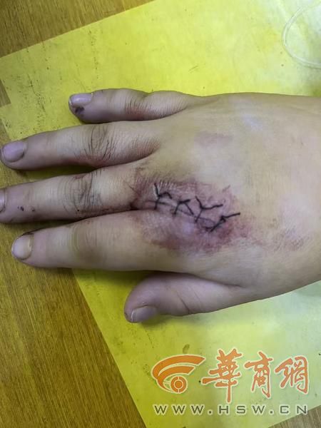 记者走访4个小区的安全隐患 居民盼望尽快消除(图2)